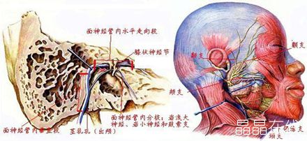 贝尔氏面瘫是如何发生的? 贝尔氏面瘫是如何发生的?